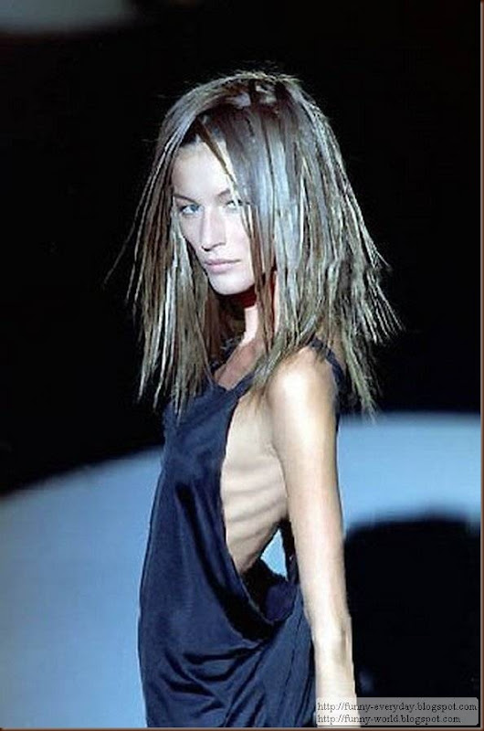 skinny-anorexic-models (6)