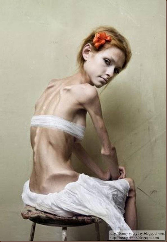 skinny-anorexic-models (7)