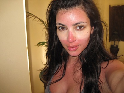 Kim Kardashian Sunburn picture