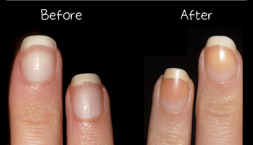 Base Coat On Your Nails, What Happens If You Don T Use Base Coat With Gel Polish