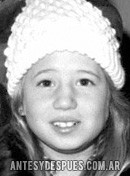 Chaz Bono, 1977