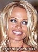 Pamela Anderson,  