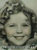Shirley Temple, 