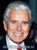 John Forsythe, 1983