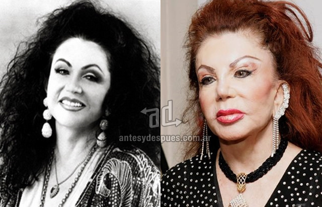 jackie stallone before surgery