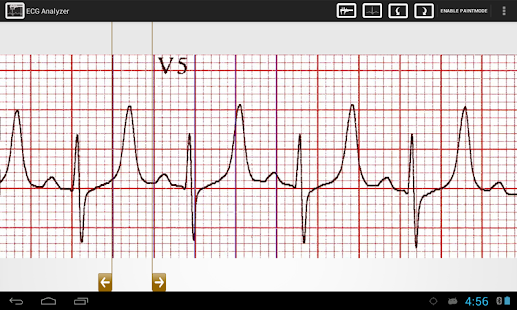 How to mod ECG Analyzer lastet apk for pc
