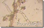 roundworm