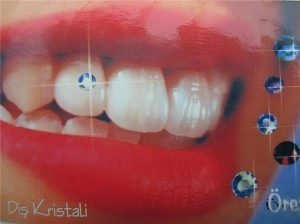 tooth-jewels