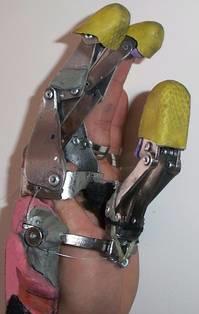 Funcionamiento Prótesis Parcial de Mano de Acero Inoxidable: Ingeniería Universidad Nacional de Colombia