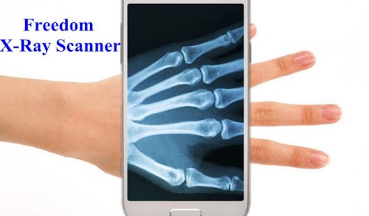Free Download Freedom X-Ray Scanner APK for Android