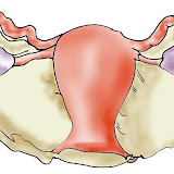 uterovpo.jpg