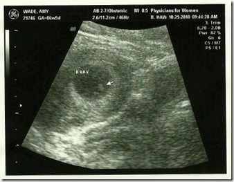 first ultrasound