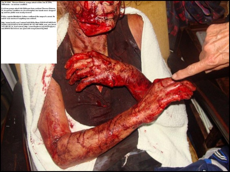 Theresa Eksteen panga attack survivor Jan262010 Stilfontein farm 51 serious condition