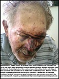 Bronkhorst Chris tortured smallholder dies from maltreatment in hospice May242011