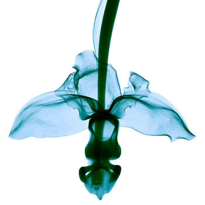 X Ray Flowers...***EXCLUSIVE***UNSPECIFED - UNDATED: X-ray of an orchid flower (Stanhopea hasselvoliana).These mesmerising shots are the fruit of years of careful experimentation by artist Hugh Turvey, using x-rays to really get under the surface of things. The technique, which came about thanks to a chance commission from a musician friend who wanted an x-ray image, has been 14 years in the making and has now been so well honed by Hugh that his work is becoming highly sought after. The flowers are the latest in a long line of subjects, including motorbikes, suitcases and stiletto-clad feet.PHOTOGRAPH BY SPL / BARCROFT MEDIA LTDUK Office, London.T +44 845 370 2233W www.barcroftmedia.comUSA Office, New York City.T +1 212 564 8159W www.barcroftusa.comIndian Office, Delhi.T +91 114 653 2118W www.barcroftindia.comAustralasian & Pacific Rim Office, Melbourne.E info@barcroftpacific.comT +613 9510 3188 or +613 9510 0688W www.barcroftpacific.com