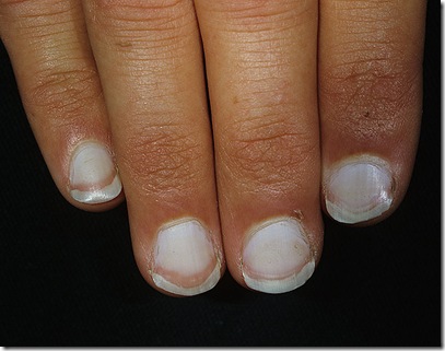 white-nails-1