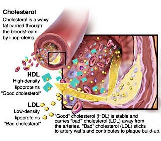 cholesterol01