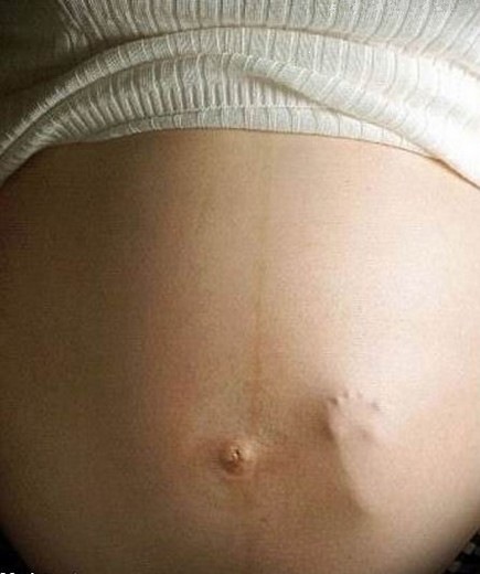 [embarazada-pie[4].jpg]