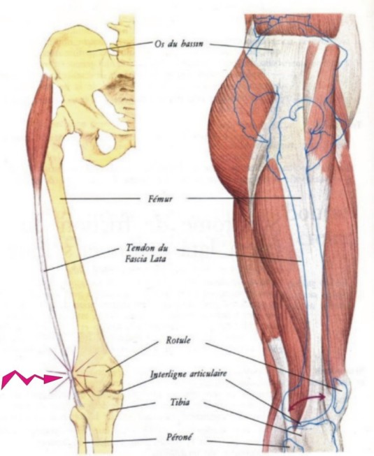comment traiter une tendinite du genou