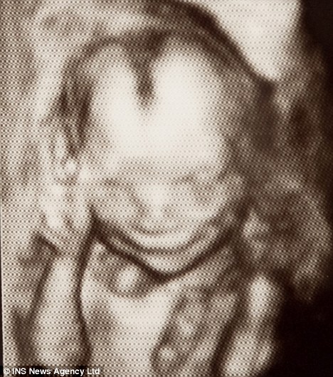 Descubrimiento de que los fetos sonríen a las 17 semanas