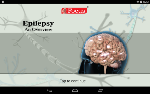 【免費醫療App】Epilepsy-An Overview-APP點子