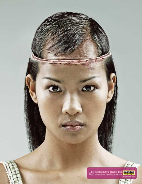 Female scalp