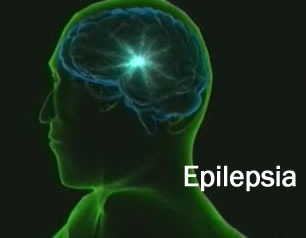 [epilepsia[3].jpg]