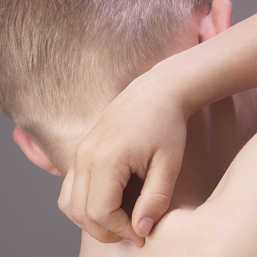 Tout Savoir Sur L Urticaire Algerie360