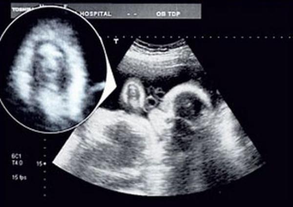 Jēzus seja ultrasonogrāfijas attēlā