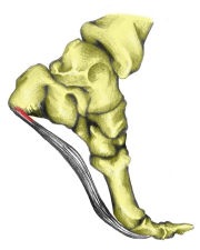 180plantar_fasciitis