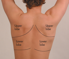 posterior lung markings