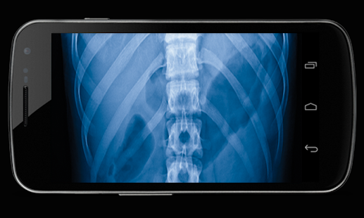 Body Xray- Prank Screenshots 3
