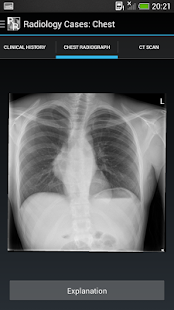 Radiology Cases: Chest