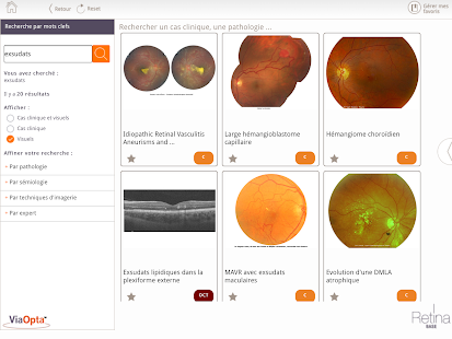 Retina Base Screen 3