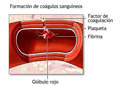 rbbb