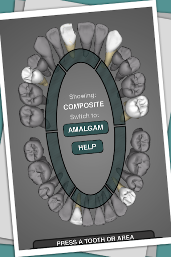 CavSim - Dental Cavity Preps