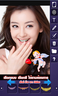 Download แต่งรูปดัดฟัน APK for PC