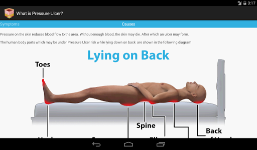【免費健康App】Pressure Ulcer Guide-APP點子