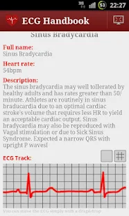 免費下載醫療APP|Heart ECG Handbook - Full app開箱文|APP開箱王