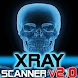 X-Ray Scanner v2.0
