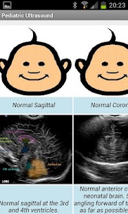 How to get Pediatric Ultrasound 1.0 mod apk for pc