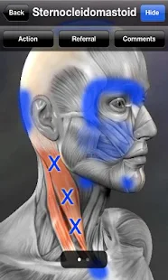 Muscle Trigger Point Anatomy - screenshot thumbnail