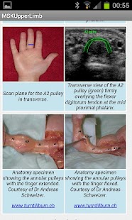 How to mod MSK ultrasound upper limb Lite 1.0 unlimited apk for bluestacks