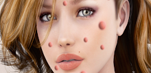 Fashion Model Zit Popper 2 APK