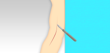 elbow surgery games APK