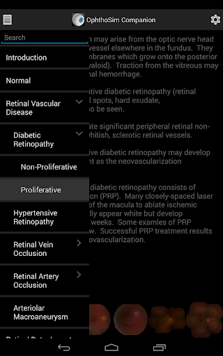 免費下載醫療APP|OphthoSim Companion app開箱文|APP開箱王