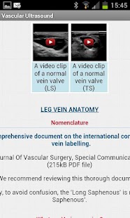 Vascular Ultrasound Screenshots 4