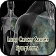 Lung Cancer Causes Symptoms APK