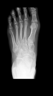 Free Xray-Scanner APK for PC