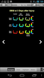 Neurotrauma 2012 poster 4